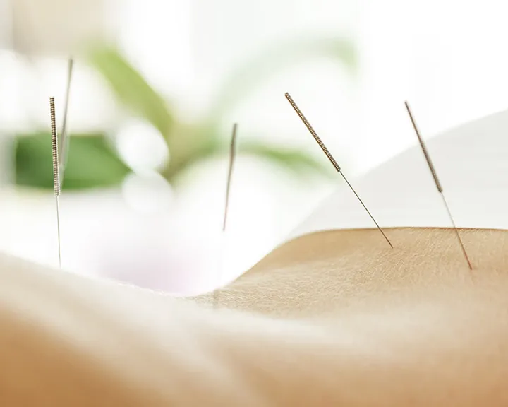 Acupuncture treatment room from Acupuncture Health Center